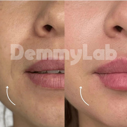 DemmyLab - Spazzola Viso Linfodrenante